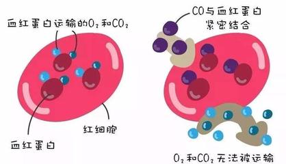 警惕洗澡季隱形殺手 一氧化碳中毒康復(fù)后，當(dāng)心遲發(fā)性腦病
